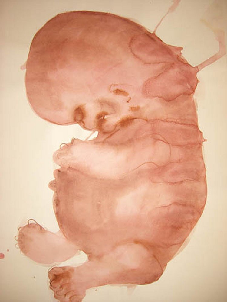 die-ungeborenen-59x415-2006-3.jpg
